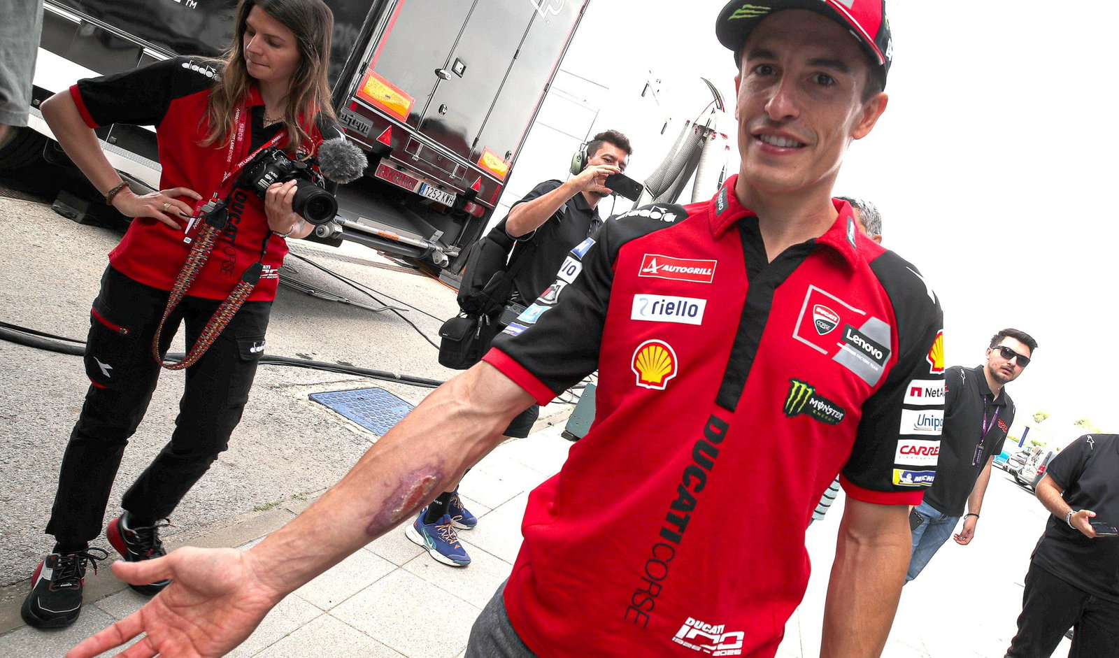 Marc Marquez shows COTA arm injury, 2026 Spanish MotoGP.